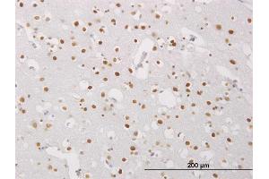 Immunoperoxidase of monoclonal antibody to MECP2 on formalin-fixed paraffin-embedded human cerebral cortex. (MECP2 抗体  (AA 81-170))