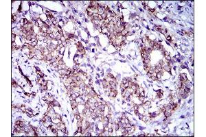 Immunohistochemistry (IHC) image for anti-Activated Leukocyte Cell Adhesion Molecule (ALCAM) (AA 48-216) antibody (ABIN1724851)