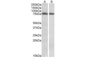 AP23695PU-N STK39 / SPAK Antibody of Mouse (A) and Rat (B) Brain (35µg protein in RIPA buffer). (STK39 抗体  (Internal Region))
