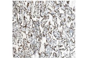 IHC analysis of DDX5 using anti-DDX5 antibody (ABIN7602561). (DDX5 抗体  (AA 85-328))