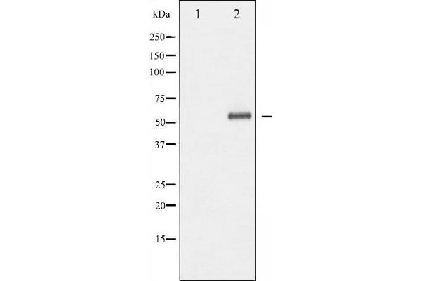 ELK1 抗体  (pSer389)
