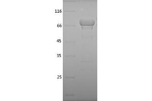 Western Blotting (WB) image for Heat Shock 70kDa Protein 5 (Glucose-Regulated Protein, 78kDa) (HSPA5) (AA 19-654) protein (His tag) (ABIN7123271)