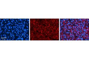 Rabbit Anti-PDLIM5 Antibody   Formalin Fixed Paraffin Embedded Tissue: Human Liver Tissue Observed Staining: Cytoplasm in hepatocytes Primary Antibody Concentration: 1:100 Other Working Concentrations: N/A Secondary Antibody: Donkey anti-Rabbit-Cy3 Secondary Antibody Concentration: 1:200 Magnification: 20X Exposure Time: 0. (PDLIM5 抗体  (Middle Region))