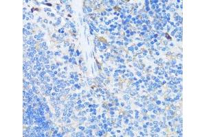 Immunohistochemistry of paraffin-embedded Mouse spleen using EIF3J Polyclonal Antibody at dilution of 1:100 (40x lens).