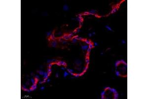 Immunofluorescence of paraffin embedded rat skin using collagen alpha-1 (V) (ABIN7073547) at dilution of 1: 1500 (400x lens) (Collagen Type V 抗体)