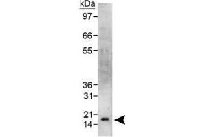 Western blot analysis of CBX5 in HeLa whole cell lysate using CBX5 polyclonal antibody . (CBX5 抗体  (AA 1-100))