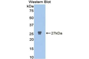 Western Blotting (WB) image for anti-Matrix Metalloproteinase 2 (MMP2) (AA 445-660) antibody (ABIN1078307) (MMP2 抗体  (AA 445-660))