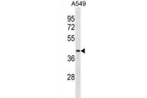 Western Blotting (WB) image for anti-Dipeptidase 1 (Renal) (DPEP1) antibody (ABIN3001069) (DPEP1 抗体)