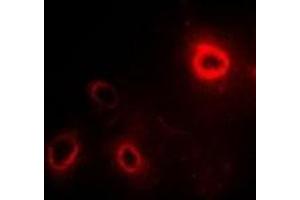 Immunofluorescent analysis of RPLP1 staining in SW480 cells. (RPLP1 抗体)