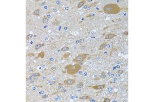 Immunohistochemistry of paraffin-embedded rat brain using EIF2S3 antibody (ABIN6130363, ABIN6140051, ABIN6140052 and ABIN6222259) at dilution of 1:100 (40x lens). (EIF2S3 抗体  (AA 173-472))