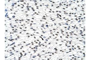 SURF6 antibody was used for immunohistochemistry at a concentration of 4-8 ug/ml to stain Myocardial cells (arrows) in Human Heart. (SURF6 抗体  (Middle Region))