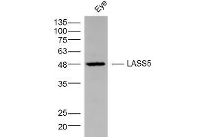 Mouse Eye lysates probed with LASS5 Polyclonal Antibody, Unconjugated  at 1:300 dilution and 4˚C overnight incubation. (LASS5 抗体  (AA 101-200))