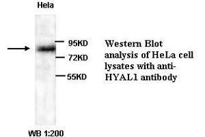 Image no. 1 for anti-Hyaluronidase-1 (HYAL1) (Internal Region) antibody (ABIN791003) (HYAL1 抗体  (Internal Region))