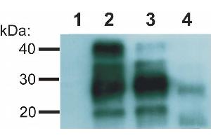 Western blotting analysis of Creutzfeld-Jakob disease (CJD) negative (lane 1, 2) and CJD positive (lane 3, 4) human brain material using anti-PrP antibody (clone EM-20). (PRNP 抗体)