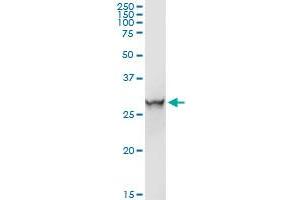 ORM1 MaxPab rabbit polyclonal antibody. (ORM1 抗体  (AA 1-201))