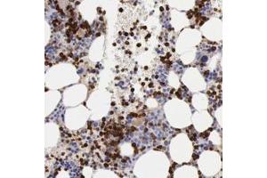 Immunohistochemistry (Formalin/PFA-fixed paraffin-embedded sections) of human bone marrow with FCN1 polyclonal antibody  shows strong cytoplasmic positivity in bone marrow poietic cells. (FCN1 抗体)