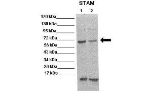WB Suggested Anti-STAM Antibody  Positive Control: Lane 1: 20ug mouse brain extract Lane 2: 20ug mouse brain extract Primary Antibody Dilution :  1:500 Secondary Antibody : Anti rabbit-HRP  Secondry Antibody Dilution :  1:5,000 Submitted by: Scott Wilson, University of Alabama at Birmingham (STAM 抗体  (N-Term))