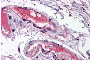 Human Vessels: Formalin-Fixed, Paraffin-Embedded (FFPE) (Osteopontin 抗体  (N-Term))