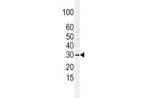 Western blot analysis of SLUG antibody and HCSMC lysate. (SLUG 抗体  (AA 1-30))
