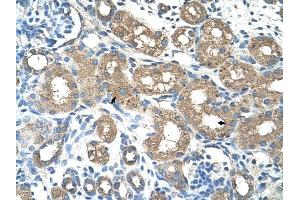 ALAS2 antibody was used for immunohistochemistry at a concentration of 4-8 ug/ml to stain Epithelial cells of renal tubule (arrows) in Human Kidney.
