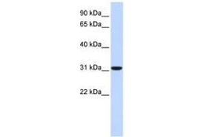 Image no. 1 for anti-Carbonic Anhydrase VIII (CA8) (C-Term) antibody (ABIN6740749) (CA8 抗体  (C-Term))