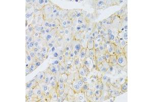 Immunohistochemistry (Paraffin-embedded Sections) (IHC (p)) image for anti-ATP-Binding Cassette, Sub-Family C (CFTR/MRP), Member 1 (ABCC1) antibody (ABIN3017211)