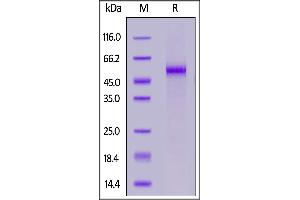 SDS-PAGE (SDS) image for delta Like Protein 3 (DLL3) (AA 27-492) (Active) protein (His tag,FITC) (ABIN7013753)