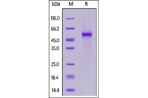 Fed Human DLL3, His Tag on  under reducing (R) condition. (DLL3 Protein (AA 27-492) (His tag,FITC))