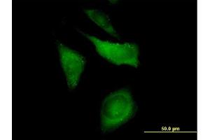 Immunofluorescence of purified MaxPab antibody to CAP1 on HeLa cell. (CAP1 抗体  (AA 1-475))