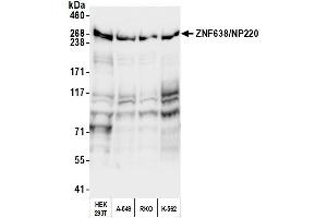 Western Blotting (WB) image for anti-Zinc Finger Protein 638 (ZNF638) (AA 225-275) antibody (ABIN7539900) (ZNF638 抗体  (AA 225-275))