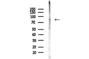 anti-rho-Related BTB Domain Containing 2 (RHOBTB2) antibody