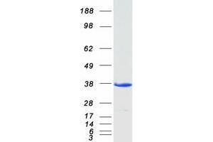 Western Blotting (WB) image for EF-Hand Domain Family, Member D1 (EFHD1) protein (Myc-DYKDDDDK Tag) (ABIN2719960)