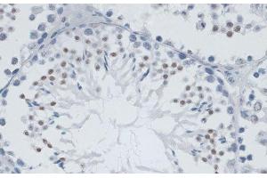 Immunohistochemistry of paraffin-embedded Mouse testis using MSH6 Polyclonal Antibody at dilution of 1:100 (40x lens). (MSH6 抗体)