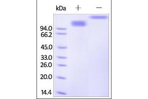 Human SCARB1, Fc Tag on SDS-PAGE under reducing (R) and no-reducing (NR) conditions.