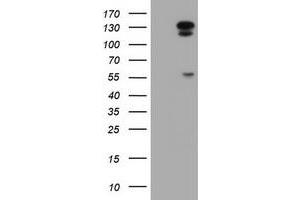 Western Blotting (WB) image for anti-ATP/GTP Binding Protein 1 (AGTPBP1) (AA 368-753) antibody (ABIN1491462) (AGTPBP1 抗体  (AA 368-753))