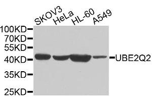 Western blot analysis of extracts of various cell lines, using UBE2Q2 antibody. (UBE2Q2 抗体  (AA 1-150))