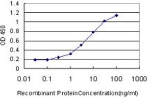 Detection limit for recombinant GST tagged CA1 is approximately 0. (CA1 抗体  (AA 1-261))