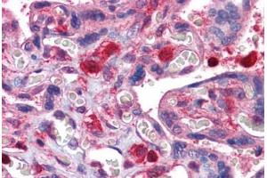 Human Placenta: Formalin-Fixed, Paraffin-Embedded (FFPE) (GDI2 抗体  (AA 1-197))