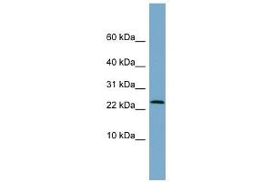 LRRC20 antibody used at 1 ug/ml to detect target protein. (LRRC20 抗体  (Middle Region))