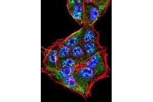 Immunofluorescence (IF) image for anti-Potassium Intermediate/small Conductance Calcium-Activated Channel, Subfamily N, Member 2 (KCNN2) (AA 36-52) antibody (ABIN5542523)