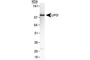 Western blot analysis of LPO in MDA-MB-231 cell lysate using LPO polyclonal antibody . (LPO 抗体  (AA 300-400))