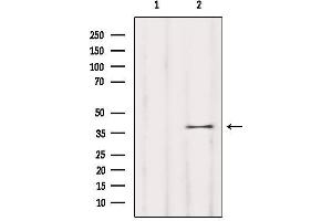 Western blot analysis of extracts from Mouse brain, using OR5T1 Antibody. (OR5T1 抗体)