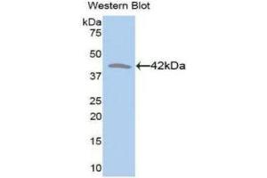 Western Blotting (WB) image for anti-Creatine Kinase, Muscle (CKM) (AA 11-367) antibody (ABIN3209308) (CKM 抗体  (AA 11-367))