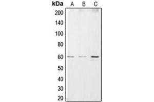 Western blot analysis of CSRNP2 expression in HEK293T (A), HepG2 (B), HuvEC (C) whole cell lysates. (CSRNP2 抗体  (Center))