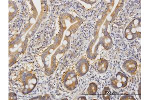 Immunoperoxidase of monoclonal antibody to ROCK2 on formalin-fixed paraffin-embedded human small Intestine. (ROCK2 抗体  (AA 1279-1388))