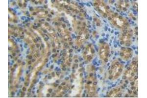 Immunohistochemistry (IHC) image for anti-Glutamic-Oxaloacetic Transaminase 1, Soluble (Aspartate Aminotransferase 1) (GOT1) (AA 1-413) antibody (ABIN7433267)