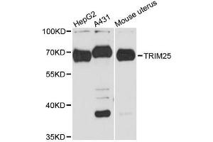 Western blot analysis of extracts of various cell lines, using TRIM25 antibody. (TRIM25 抗体  (AA 100-400))