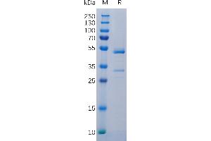 Human TN Protein, hFc Tag on SDS-PAGE under reducing condition.
