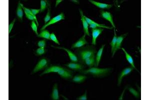 Immunofluorescence (IF) image for anti-Pyruvate Kinase M1/2 (PKM) (AA 185-461) antibody (ABIN7166908)