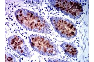 Immunohistochemical analysis of paraffin-embedded colon tissues using MUC2 mouse mAb with DAB staining.